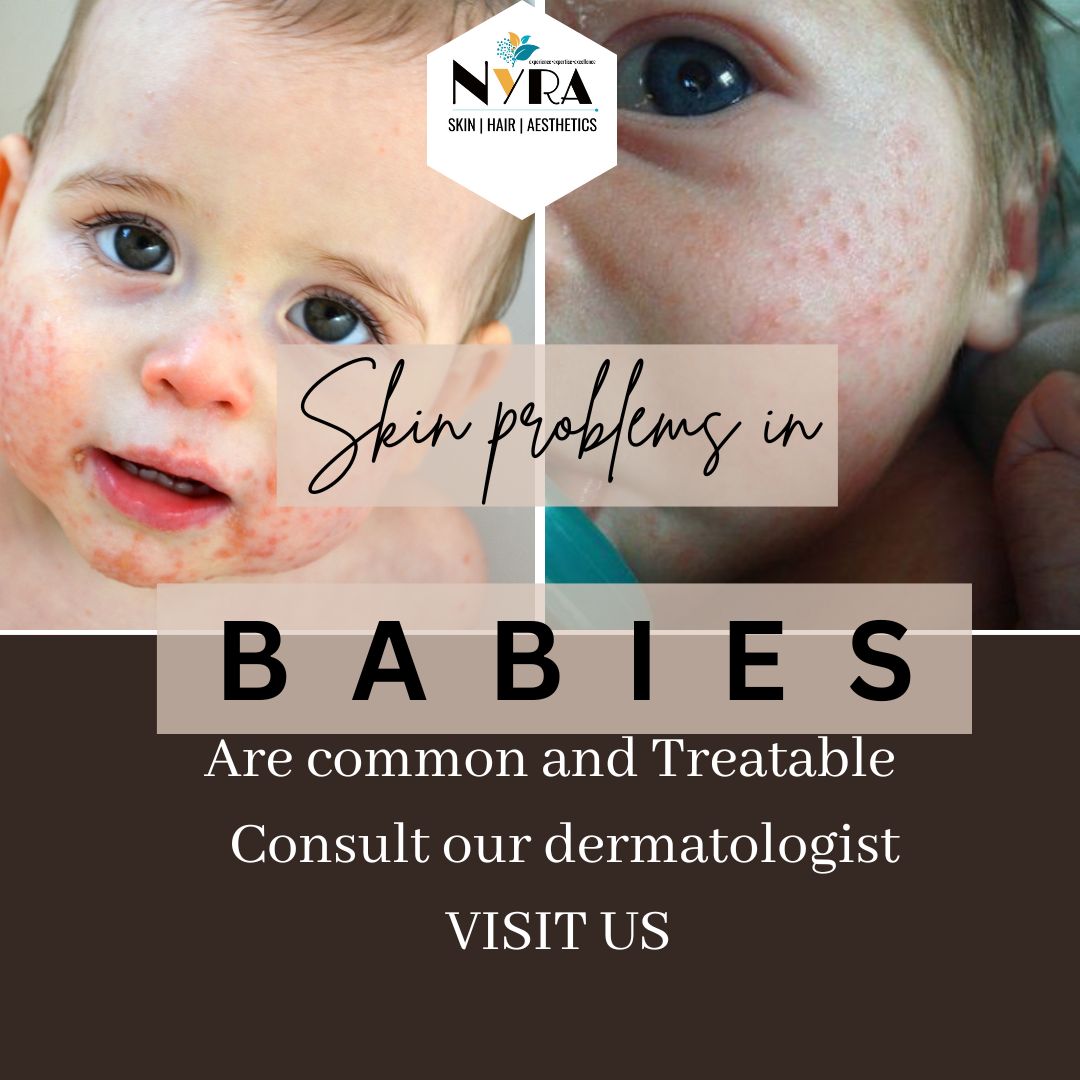 Gallery | NYRA Skin, Hair & Aesthetic Clinic | Dr Rohit Gupta MBBS MD ...